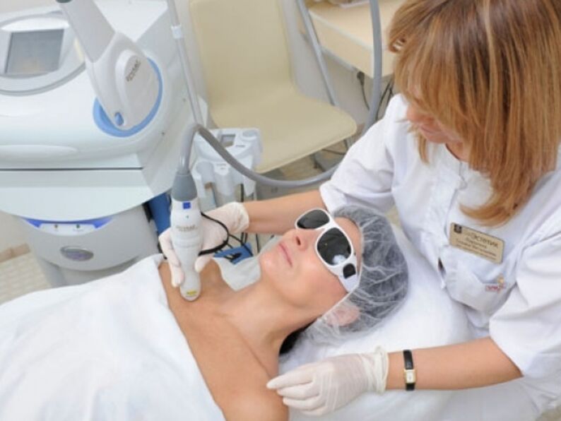 procedura de întinerire a pielii cu laser