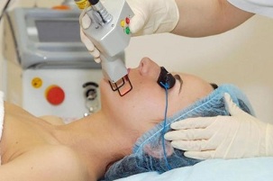 tipuri de întinerire a pielii faciale cu laser